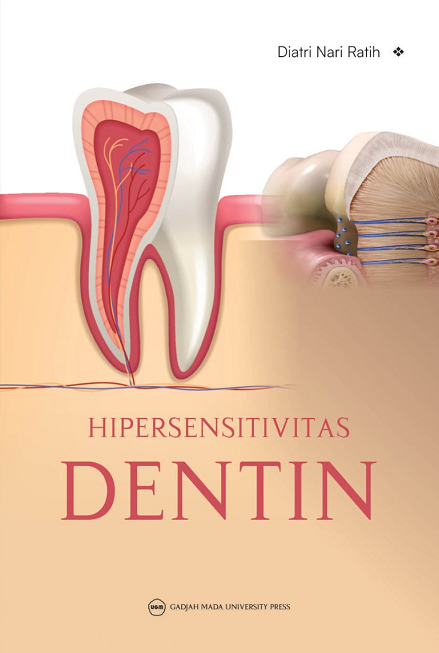 Hipersensitivitas Dentin