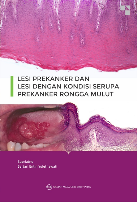Lesi Prekanker dan Lesi dengan Kondisi…