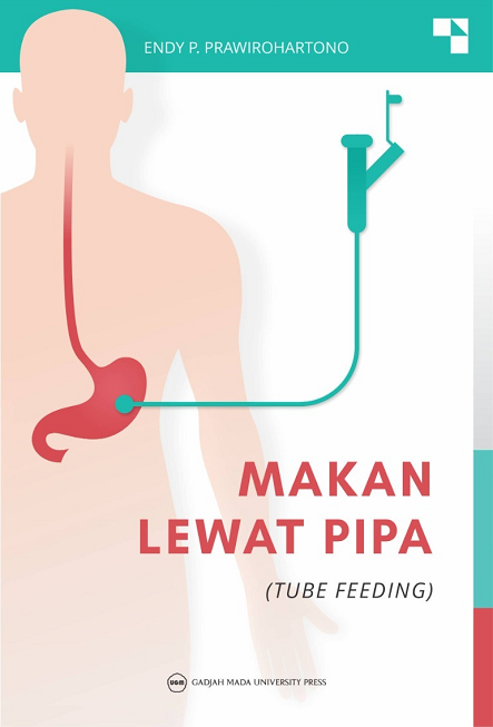 Makan Lewat Pipa (Tube Feeding)