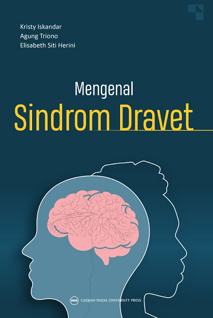 Mengenal Sindrom Dravet