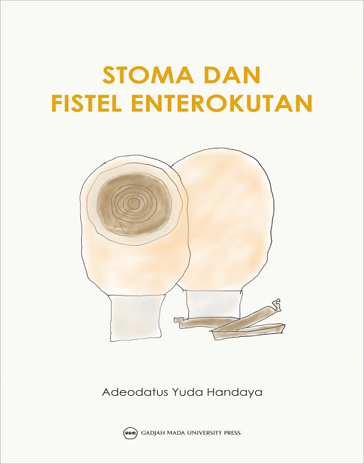 Stoma Dan Fistel Enterokutan